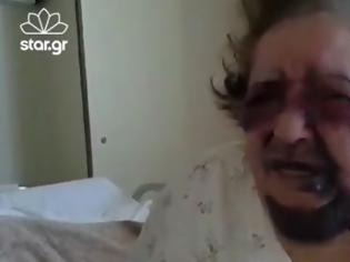 Φωτογραφία για Άγριος ξυλοδαρμός 83χρονης για να της αρπάξουν τη σύνταξη – ΕΙΚΟΝΕΣ ΣΟΚ (VIDEO)