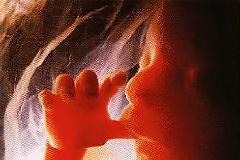 Νόμιμες οι εκτρώσεις στην Αργεντινή στις περιπτώσεις βιασμού.