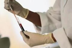 Ηλικιωμένη από την επαρχία έχει AIDS