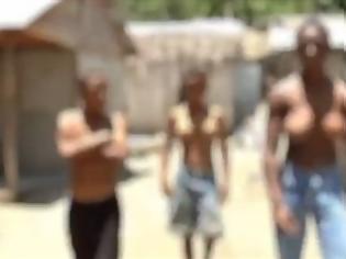 Φωτογραφία για VIDEO: Τρία αδέρφια πάσχουν από γυναικομαστία