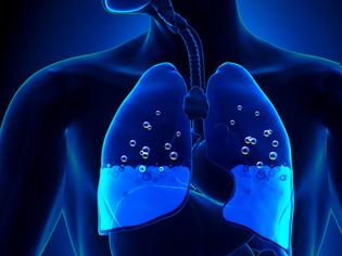 Φωτογραφία για Τα «μικρά» συμπτώματα που δείχνουν συσσώρευση υγρού στον πνεύμονα