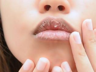 Φωτογραφία για 6 συνήθειες που ευθύνονται για τα σκασμένα χείλη σου