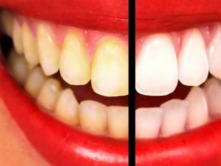 Φωτογραφία για Δείτε πως θα αποκτήσετε το πιο λαμπερό χαμόγελο! 9 θαυματουργές συνταγές για κάτασπρα δόντια!