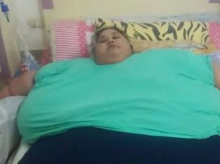 Φωτογραφία για Επιτυχημένη η χειρουργική επέμβαση της γυναίκας που ζύγιζε 500 κιλά