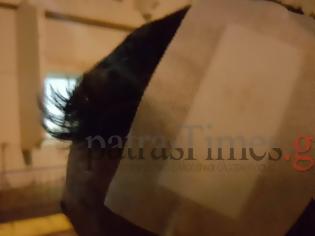 Φωτογραφία για Πάτρα: Του άνοιξαν το κεφάλι με τενεκέ από σίδηρο – Τον χτύπαγαν 20 άτομα [photos]