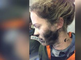 Φωτογραφία για Τρομακτικτό ατύχημα: Εξερράγησαν τα ακουστικά στο πρόσωπό της εν μέσω πτήσ