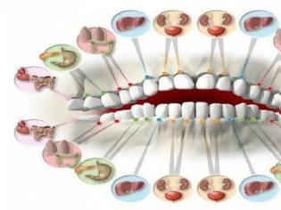 Φωτογραφία για Γνωρίζετε ότι ο πονόδοντος δείχνει ότι πάσχετε από κάποια άλλη ασθένεια; Δείτε με ποίο όργανο συνδέεται το κάθε δόντι!