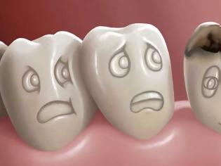 Φωτογραφία για Μεγάλη προσοχή: Χαλασμένα δόντια; Ποιους κινδύνους κρύβουν για την υγεία