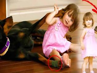 Φωτογραφία για Ο σκύλος δάγκωσε την 17 μηνών κόρη της και την πέταξε μακρυά -Μόλις κατάλαβε γιατί το είχε κάνει, πάγωσε!