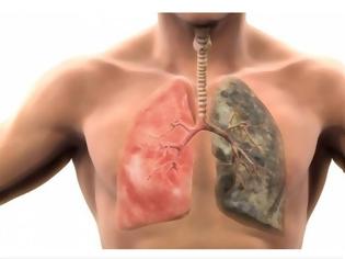 Φωτογραφία για Αυτές είναι οι τροφές που καθαρίζουν τους πνεύμονες από τη νικοτίνη