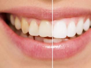Φωτογραφία για Πιο λευκά δόντια: Κάντε μπουκώματα με αυτό το φυσικό διάλυμα... [video]