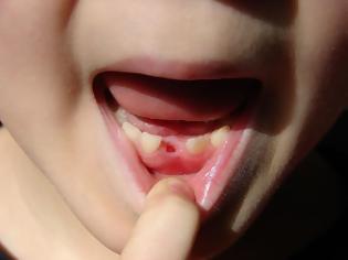 Φωτογραφία για Να γιατί πρέπει οι γονείς να κρατούν τα πρώτα δόντια των παιδιών τους
