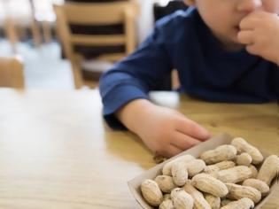 Φωτογραφία για Ποιες τροφές είναι υπεύθυνες για τις παιδικές αλλεργίες