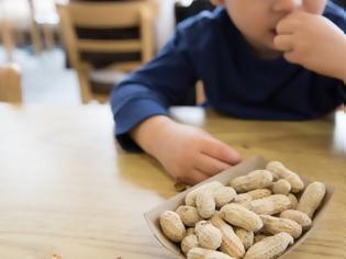 Φωτογραφία για Ποιες τροφές είναι υπεύθυνες για τις παιδικές αλλεργίες
