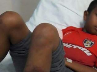Φωτογραφία για Μαστίγωσαν μέχρι θανάτου 11χρονο με λάστιχο στο σχολείο του
