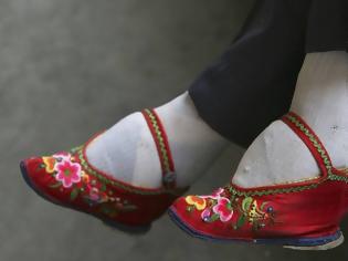 Φωτογραφία για Τα πόδια του λωτού: Το απάνθρωπο κινέζικο έθιμο - Ο πραγματικός λόγος που οι Κινέζες έδεναν τα πόδια τους