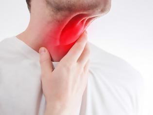 Φωτογραφία για Καρκίνος στον λαιμό: Προσοχή στα «αθώα» συμπτώματα – Αίτια και παράγοντες κινδύνου