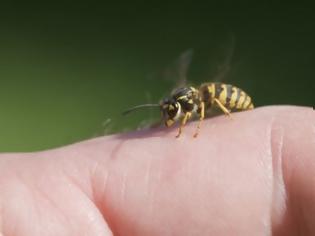 Φωτογραφία για Τσίμπημα από σφήκα ή μέλισσα: Τα σωστά βήματα άμεσης ανακούφισης