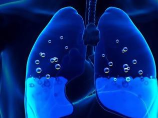 Φωτογραφία για Πνευμονικό οίδημα: Αν νιώθετε αυτά έχετε συσσώρευση υγρού στον πνεύμονα!