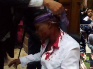 Φωτογραφία για Το απόλυτο Χάος! Υποστηρικτές του Μαδούρο μπούκαραν με ρόπαλα στο Κοινοβούλιο - Τραυματίες βουλευτές [photos]