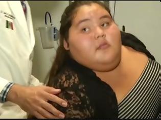 Φωτογραφία για Μπήκε στο χειρουργείο ως η πιο παχύσαρκη έφηβη του κόσμου. 9 μήνες αργότερα - Δείτε πώς είναι σήμερα...