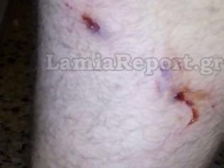 Φωτογραφία για Στυλίδα: Επίθεση αδέσποτων σε 34χρονο στο Μαρίνι