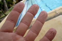 Γιατί ζαρώνουν τα δάχτυλά μας μέσα στο νερό – Όχι, δεν είναι επειδή «μούλιασαν»