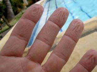 Φωτογραφία για Γιατί ζαρώνουν τα δάχτυλά μας μέσα στο νερό – Όχι, δεν είναι επειδή «μούλιασαν»