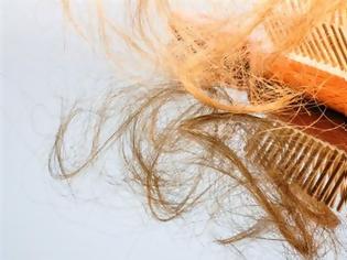 Φωτογραφία για Απώλεια μαλλιών: Τρεις φυσικές θεραπείες