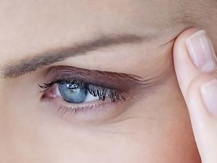 Φωτογραφία για 3 τρόποι για εξαφανίσετε τις ρυτίδες γύρω από τα μάτια
