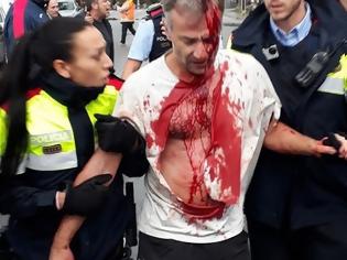 Φωτογραφία για Σκηνές βίας στο δημοψήφισμα της Καταλονίας