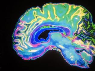 Φωτογραφία για Τι συμβαίνει στον εγκέφαλο ενός ατόμου με κατάθλιψη; [video]