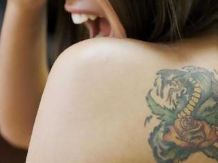 Φωτογραφία για Παλιό τατουάζ προκάλεσε σε γυναίκα καρκίνο (φωτο)