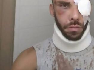 Φωτογραφία για Μεγάλη ανατροπή: Δεν ξυλοκοπήθηκε από ντόπιους ο 30χρονος φοιτητής στο Ρέθυμνο