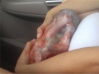 Φωτογραφία για Γέννησε μέσα στο αμάξι, με το μωρό ακόμα μέσα στον αμνιακό σάκο