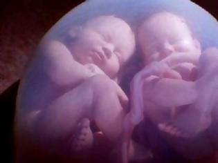 Φωτογραφία για Επιστημονικό παράδοξο: Έμεινε έγκυος ενώ ήταν ήδη έγκυος