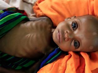 Φωτογραφία για Ο ΟΗΕ προειδοποιεί για μεγάλο λιμό με εκατομμύρια θύματα στην Υεμένη