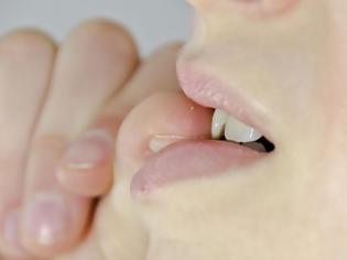 Φωτογραφία για Τρώτε τα νύχια σας; Πέντε τρόποι για να σταματήσετε την κακή συνήθεια