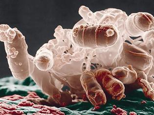 Φωτογραφία για Όμηροι πολυανθεκτικών μικροβίων