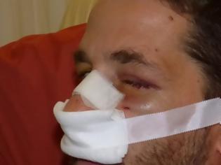 Φωτογραφία για Βρετανοί στρατιώτες ξυλοκόπησαν χωρίς λόγο 37χρονο στα Χανιά - «Με χτυπούσαν κι έλεγαν ότι θα με σκοτώσουν» [Βίντεο]