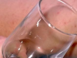 Φωτογραφία για Μηνιγγίτιδα: Το τεστ με το ποτήρι
