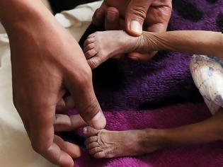 Φωτογραφία για Υεμένη: 130 παιδιά πεθαίνουν από ασιτία κάθε μέρα