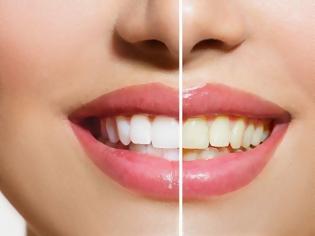 Φωτογραφία για Τα καλύτερα tricks για λευκά δόντια