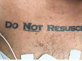 Φωτογραφία για Πώς ένα τατουάζ οδήγησε στο θάνατο ασθενούς