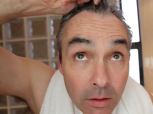 Φωτογραφία για Τι μπορεί να «κρύβει» η φαλάκρα και τα γκρίζα μαλλιά στους άνδρες κάτω των 40;