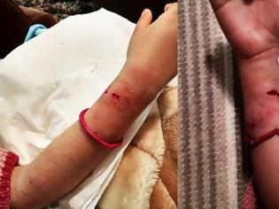 Φωτογραφία για Μυτιλήνη: Επίθεση από αδέσποτα σκυλιά σε 7χρονο κοριτσάκι στο «Χριστουγεννιάτικο Χωριό»
