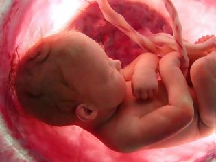Φωτογραφία για ΣΥΓΚΛΟΝΙΣΤΙΚΟ ΒΙΝΤΕΟ:  H κραυγή απελπισίας ενός εμβρύου... [video]