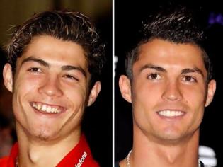 Φωτογραφία για Cristiano Ronaldo: Το πριν και το μετά τις πλαστικές του παίκτη των 93 εκατομμυρίων Ο Ronaldo άλλαξε, αλλά οι φωτογραφίες μένουν…