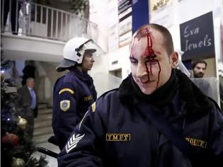 Φωτογραφία για Ασυνάρτητες εντολές - Απεχθές αίτημα ενημέρωσης από τραυματισμένο αστυνομικό