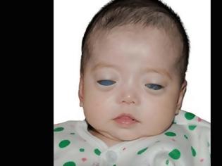 Φωτογραφία για Κανείς δεν ήθελε αυτό το μωρό με τα Ασημένια Διαπεραστικά Μάτια - Μια φωτογραφία όμως άλλαξε τα πάντα!